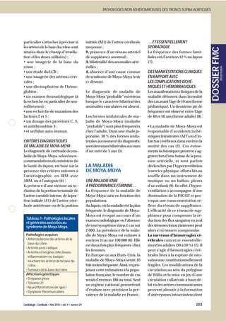 PATHOLOGIES NON ATHÉROMATEUSES DES TRONCS SUPRA-AORTIQUES




particulier s’attacher à préciser si                      initiale (M1) de l’artère cérébrale    … ET ESSENTIELLEMENT
les artères de la base du crâne sont                      moyenne ;                              SPORADIQUE




                                                                                                                                        DOSSIER FMC
situées dans le champ d’irradia-                          2. présence d’un réseau artériel       La fréquence des formes fami-
tion et les doses utilisées) ;                            de suppléance anormal ;                liales est d’environ 12 % au Japon
• une imagerie de la base du                              3. bilatéralité des anomalies arté-    (7).
crâne ;                                                   rielles ;




                                                                                                                                                 détachable
• une étude du LCR ;                                      4. absence d’une cause connue          DES MANIFESTATIONS CLINIQUES
• une imagerie des artères cervi-                         de syndrome de Moya-Moya (voir         EN RAPPORT AVEC
cales ;                                                   ci-dessus).                            LES COMPLICATIONS ISCHÉ-
• une électrophorèse de l’hémo-                                                                  MIQUES ET HÉMORRAGIQUES
globine ;                                                 Le diagnostic de maladie de            Les manifestations cliniques de la
• un examen dermatologique (à                             Moya-Moya “probable” est retenu        maladie débutent dans la moitié
la recherche en particulier de neu-                       lorsque le caractère bilatéral des     des cas avant l’âge de 10 ans (forme
rofibromes) ;                                             anomalies vasculaires est absent.      pédiatrique). Un deuxième pic de
• une recherche de mutations des                                                                 fréquence est observé entre l’âge
facteurs 2 et 5 ;                                         Les formes unilatérales de ma-         de 40 et 50 ans (forme adulte) (8).
• un dosage des protéines C, S,                           ladie de Moya-Moya (maladie
et antithrombine 3 ;                                      “probable”) sont plus fréquentes       • La maladie de Moya-Moya est
• et un bilan auto-immun.                                 chez l’adulte. Dans une étude ja-      responsable d’accidents isché-
                                                          ponaise, 30 % des formes unila-        miques transitoires (AIT) ou d’in-
CRITÈRES DIAGNOSTIQUES                                    térales au moment du diagnostic        farctus cérébraux dans environ la
DE MALADIE DE MOYA-MOYA                                   sont devenues bilatérales au cours     moitié des cas (2). Ces évène-
Le diagnostic de certitude de ma-                         d’un suivi de 5 ans (5).               ments ischémiques peuvent s’ag-
ladie de Moya-Moya, selon les re-                                                                graver lors d’une baisse de la pres-
commandations du ministère de                                                                    sion artérielle, et sont parfois
la Santé du Japon, est basé sur la                        LA MALADIE                             déclenchés par l’hyperventilation
présence des critères suivants à                          DE MOYA-MOYA                           (exercice physique, efforts liés au
l’artériographie, en IRM avec                                                                    souffle dans un instrument de
ARM, ou à l’autopsie (4) :                                UNE MALADIE RARE                       musique ou un ballon, pleurs
1. présence d’une sténose ou oc-                          À PRÉDOMINANCE FÉMININE…               d’un enfant) (9). En effet, l’hyper-
clusion de la portion terminale de                        La fréquence de la maladie de          ventilation s’accompagne d’une
l’artère carotide interne, de la por-                     Moya-Moya varie en fonction des        diminution de la PACO2 et pro-
tion initiale (A1) de l’artère céré-                      populations.                           voque une vasoconstriction ré-
brale antérieure ou de la portion                         Au Japon, où la maladie est la plus    flexe du réseau de suppléance.
                                                          fréquente, le diagnostic de Moya-      L’efficacité de ce réseau de sup-
                                                          Moya est évoqué au cours d’un          pléance pour compenser la ré-
  Tableau 1 - Pathologies locales
                                                          examen radiologique en l’absence       duction des flux sanguins en aval
  et générales associées au
  syndrome de Moya-Moya.                                  de tout symptôme dans 1 cas sur        des sténoses intracrâniennes peut
                                                          2 000. La prévalence de la mala-       alors s’en trouver compromise.
  Pathologies acquises                                    die de Moya-Moya est estimée à         La survenue d’hémorragies cé-
  • Athérosclérose des artères de la                      environ 3 cas sur 100 000 (6). Elle    rébrales concerne essentielle-
    base du crâne
                                                          est deux fois plus fréquente chez      ment les adultes (30 à 50 %) (2). Il
  • Artérite post-radique
                                                          les femmes.                            peut s’agir d’hémorragies céré-
  • Artérites d’origines infectieuse,
    inflammatoire ou toxique                              En Europe ou aux Etats-Unis, la        brales liées à la rupture de néo-
    touchant les artères de la base du                    maladie de Moya-Moya serait 10         vaisseaux constitutionnellement
    crâne                                                 fois moins fréquente. Ainsi, en pro-   fragiles. Les modifications de la
  • Tumeurs de la base du crâne                           jetant cette estimation à la popu-     circulation au sein du polygone
  Affections génétiques                                   lation française, le nombre de cas     de Willis et la mise en jeu d’une
  • Drépanocytose                                         serait d’environ 180 au total. Seul    circulation collatérale à haut dé-
  • Trisomie 21
                                                          un registre national permettrait       bit via les artères communicantes
  • Neurofibromatose de type I
  • Dysplasie fibromusculaire
                                                          d’évaluer avec précision la pré-       peuvent aboutir à la formation
                                                          valence de la maladie en France.       d’anévrysmes intracrâniens dont

Cardiologie - Cardinale • Mai 2010 • vol. 4 • numéro 29                                                                         203
 