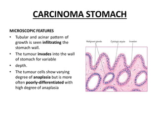 CARCINOMA STOMACH
MICROSCOPIC FEATURES
• Tubular and acinar pattern of
growth is seen infiltrating the
stomach wall.
• The tumour invades into the wall
of stomach for variable
• depth.
• The tumour cells show varying
degree of anaplasia but is more
often poorly-differentiated with
high degree of anaplasia
 