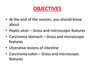 OBJECTIVES
• At the end of the session, you should know
about
• Peptic ulcer – Gross and microscopic features
• Carcinoma stomach – Gross and microscopic
features
• Ulcerative lesions of intestine
• Carcinoma colon – Gross and microscopic
features
 
