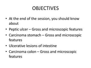 OBJECTIVES
• At the end of the session, you should know
about
• Peptic ulcer – Gross and microscopic features
• Carcinoma stomach – Gross and microscopic
features
• Ulcerative lesions of intestine
• Carcinoma colon – Gross and microscopic
features
 