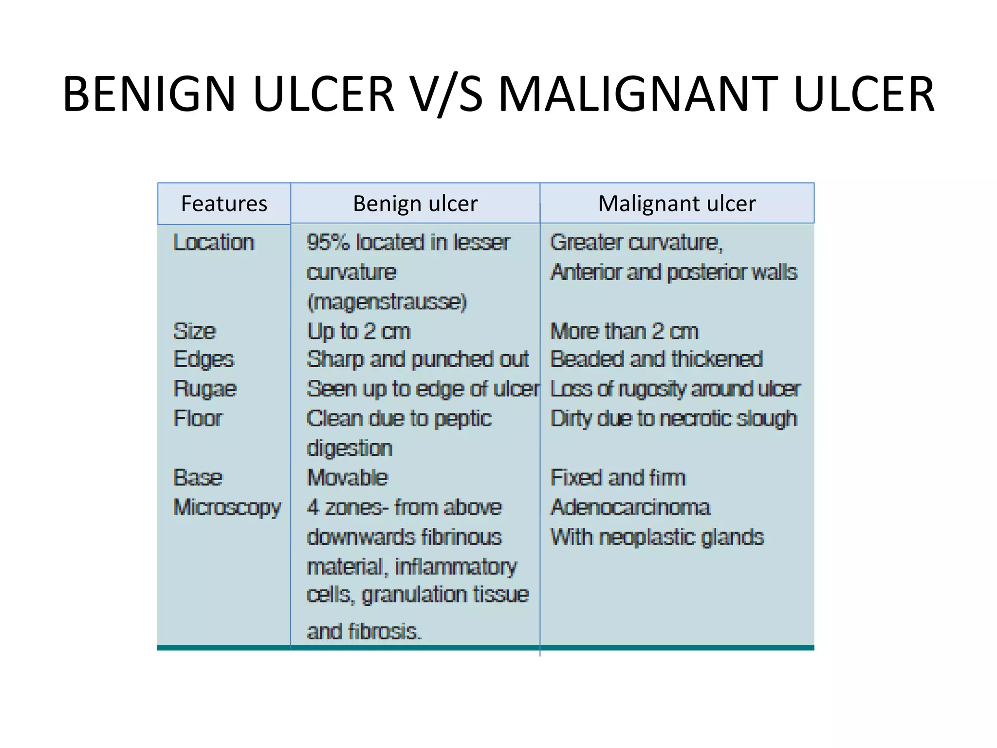 BENIGN ULCER V/S MALIGNANT ULCER
Benign ulcer Malignant ulcerFeatures
 
