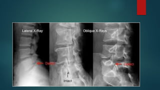 Vertebral Pathologies Introduction to Pathologies of the spine-1.pptx