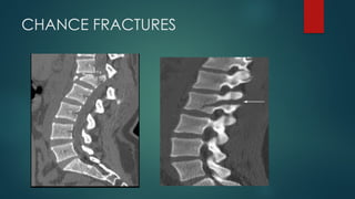 Introduction to Pathologies of the spine-1.pptx