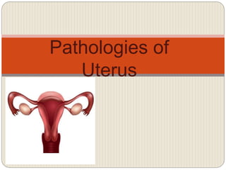 Pathologies of
Uterus
 