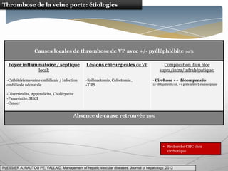 Thrombose de la veine porte: étiologies




                   Causes locales de thrombose de VP avec +/- pyéléphlébite 30%

   Foyer inflammatoire / septique                Lésions chirurgicales de VP                   Complication d’un bloc
               local:                                                                        supra/intra/infrahépatique:

  -Cathétérisme veine ombilicale / Infection    -Splénectomie, Colectomie..             - Cirrhose ++ décompensée
  ombilicale néonatale                          -TIPS                                   12-18% patients/an, ++ geste scléroT endoscopique


  -Diverticulite, Appendicite, Cholécystite
  -Pancréatite, MICI
  -Cancer


                                          Absence de cause retrouvée 20%




                                                                                               • Recherche CHC chez
                                                                                                 cirrhotique



PLESSIER A, RAUTOU PE, VALLA D. Management of hepatic vascular diseases. Journal of hepatology, 2012
 