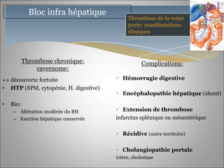 Bloc infra hépatique
                                            Thrombose de la veine
                                            porte: manifestations
                                            cliniques




           Thrombose chronique:                    Complications:
               cavernome:
++ découverte fortuite                    Hémorragie digestive
• HTP (SPM, cytopénie, H. digestive)
                                          Encéphalopathie hépatique (shunt)
•   Bio:
     – Altération modérée du BH           Extension de thrombose
     – fonction hépatique conservée    infarctus splénique ou mésentérique

                                          Récidive (autre territoire)

                                          Cholangiopathie portale
                                       ictère, cholestase
 