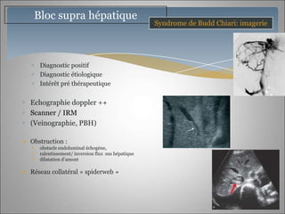 Bloc supra hépatique
                                                       Syndrome de Budd Chiari: imagerie




        Diagnostic positif
        Diagnostic étiologique
        Intérêt pré thérapeutique


  Echographie doppler ++
  Scanner / IRM
  (Veinographie, PBH)

 Obstruction :
   •    obstacle endoluminal échogène,
   •    ralentissement/ inversion flux sus hépatique
   •    dilatation d’amont

 Réseau collatéral « spiderweb »
 