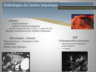 Pathologies de l’artère hépatique
                                                             Obstruction de l’artère hépatique




     Clinique:
        Asymptomatique
        Tableau d’infarctus hépatique
     Douleur abdominale, fièvre, ictère +/- signes de choc
  Biologie: hyperleucocytose, hépatite fulminante


     Echo Doppler - Scanner                                              IRM
Plage hypodense / triangulaire à base                        Cholangiopathie ischémique:
périphérique                                                   Alternance sténose dilatation
                                                               canaux biliaires
Biliome intra hépatique
                                                               ++ central
 