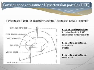 Conséquence commune : Hypertension portale (HTP)



 = P portale > 15mmHg ou différence entre Pportale et Pcave > 5 mmHg


                                              Bloc supra hépatique
                                              V centrolobulaires  VCI
                                              Insuffisance cardiaque droite


                                              Bloc intra hépatique
                                              ++ cirrhose
                                              HTPNC


                                              Bloc infra hépatique
                                              Veine porte
 