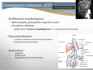 Conséquence commune : HTP
                                                         Physiopathologie



  Modifications morphologiques:
       Splénomégalie, gastropathie congestive, ascite
       Circulation collatérale
          porto cave: Varices œsophagiennes ++; porto porte (cavernome)


  Hyperartérialisation
         troubles de perfusion du parenchyme hépatique
        Modifications architecturales



  Explorations:
  1.      Imagerie
  2.      Endoscopie
  3.      Explorations hémodynamiques
 