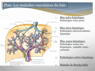Plan: Les maladies vasculaires du foie


                               1.   Bloc infra hépatique:
                                    Pathologies veine porte


                               2. Bloc intra hépatique:
                                    Pathologies microcirculation
                                    hépatique


                               3. Bloc supra hépatique:
                                    Pathologies veines sus
                                    hépatiques , maladie veino-
                                    occlusive


                               4. Pathologies artère hépatique

                               5. Maladie de Rendu Osler
 