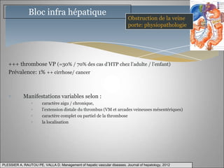 Bloc infra hépatique
                                                                          Obstruction de la veine
                                                                          porte: physiopathologie




   +++ thrombose VP (=30% / 70% des cas d’HTP chez l’adulte / l’enfant)
   Prévalence: 1% ++ cirrhose/ cancer



            Manifestations variables selon :
                       caractère aigu / chronique,
                       l’extension distale du thrombus (VM et arcades veineuses mésentériques)
                       caractère complet ou partiel de la thrombose
                       la localisation




PLESSIER A, RAUTOU PE, VALLA D. Management of hepatic vascular diseases. Journal of hepatology, 2012
 