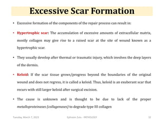 Scar Process PATHOLOGY - lecture - Healing & Repair.pdf