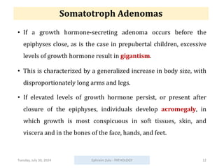 Somatotroph Adenomas
• If a growth hormone-secreting adenoma occurs before the
epiphyses close, as is the case in prepubertal children, excessive
levels of growth hormone result in gigantism.
• This is characterized by a generalized increase in body size, with
disproportionately long arms and legs.
• If elevated levels of growth hormone persist, or present after
closure of the epiphyses, individuals develop acromegaly, in
which growth is most conspicuous in soft tissues, skin, and
viscera and in the bones of the face, hands, and feet.
Tuesday, July 30, 2024 Ephraim Zulu - PATHOLOGY 12
 