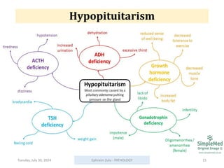 Tuesday, July 30, 2024 Ephraim Zulu - PATHOLOGY 15
Hypopituitarism
 