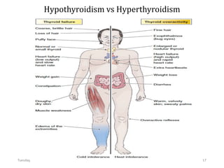 Hypothyroidism vs Hyperthyroidism
Tuesday, July 30, 2024 Ephraim Zulu - PATHOLOGY 17
 