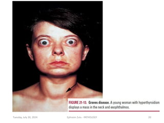 Tuesday, July 30, 2024 Ephraim Zulu - PATHOLOGY 20
 