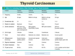 Tuesday, July 30, 2024 Ephraim Zulu - PATHOLOGY 31
Thyroid Carcinomas
 