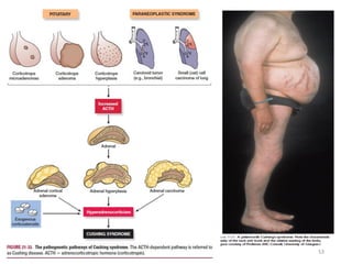 Tuesday, July 30, 2024 Ephraim Zulu - PATHOLOGY 53
 