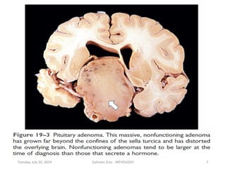 Tuesday, July 30, 2024 Ephraim Zulu - PATHOLOGY 7
 