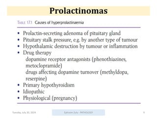 Prolactinomas
Tuesday, July 30, 2024 Ephraim Zulu - PATHOLOGY 9
 