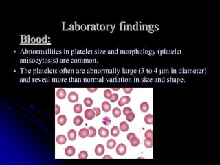 Laboratory findings
Blood:
 Abnormalities in platelet size and morphology (platelet
anisocytosis) are common.
 The platelets often are abnormally large (3 to 4 μm in diameter)
and reveal more than normal variation in size and shape.
 
