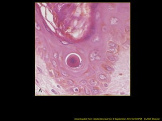 Downloaded from: StudentConsult (on 8 September 2010 02:59 PM) © 2005 Elsevier
 