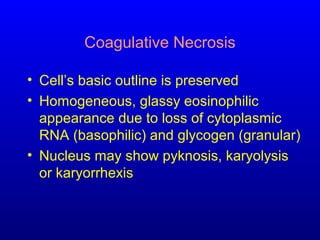 Coagulative Necrosis
• Cell’s basic outline is preserved
• Homogeneous, glassy eosinophilic
appearance due to loss of cytoplasmic
RNA (basophilic) and glycogen (granular)
• Nucleus may show pyknosis, karyolysis
or karyorrhexis
 