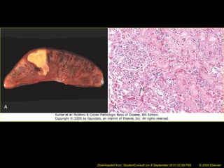 Downloaded from: StudentConsult (on 8 September 2010 02:58 PM) © 2005 Elsevier
 