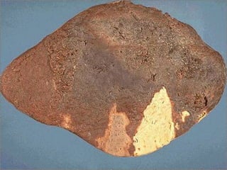 Splenic infarcts -- gross
 