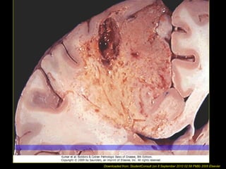 Downloaded from: StudentConsult (on 8 September 2010 02:58 PM)© 2005 Elsevier
 