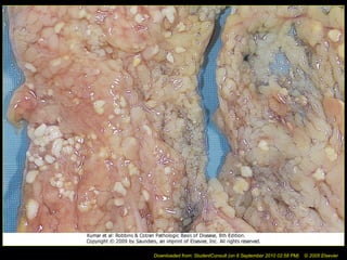 Downloaded from: StudentConsult (on 8 September 2010 02:58 PM) © 2005 Elsevier
 