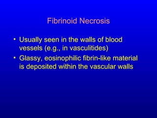 Fibrinoid Necrosis
• Usually seen in the walls of blood
vessels (e.g., in vasculitides)
• Glassy, eosinophilic fibrin-like material
is deposited within the vascular walls
 