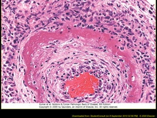 Downloaded from: StudentConsult (on 8 September 2010 02:58 PM) © 2005 Elsevier
 