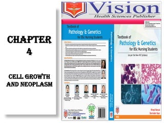 CHAPTER
4
CELL GROWTH
AND NEOPLASM
 