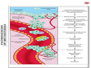 Pathogenesis
of
metastases
 