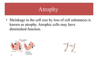 PATHOLOGY -Dr- Ammar Omar -Assistant professor of Histopathology ...