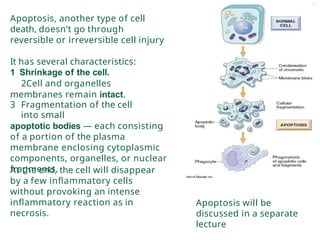 Comprehensive Review of Reversible and Irreversible Cell Injury in ...