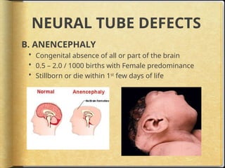 Brainless Child pathology -of- the- nervous- system.pptx