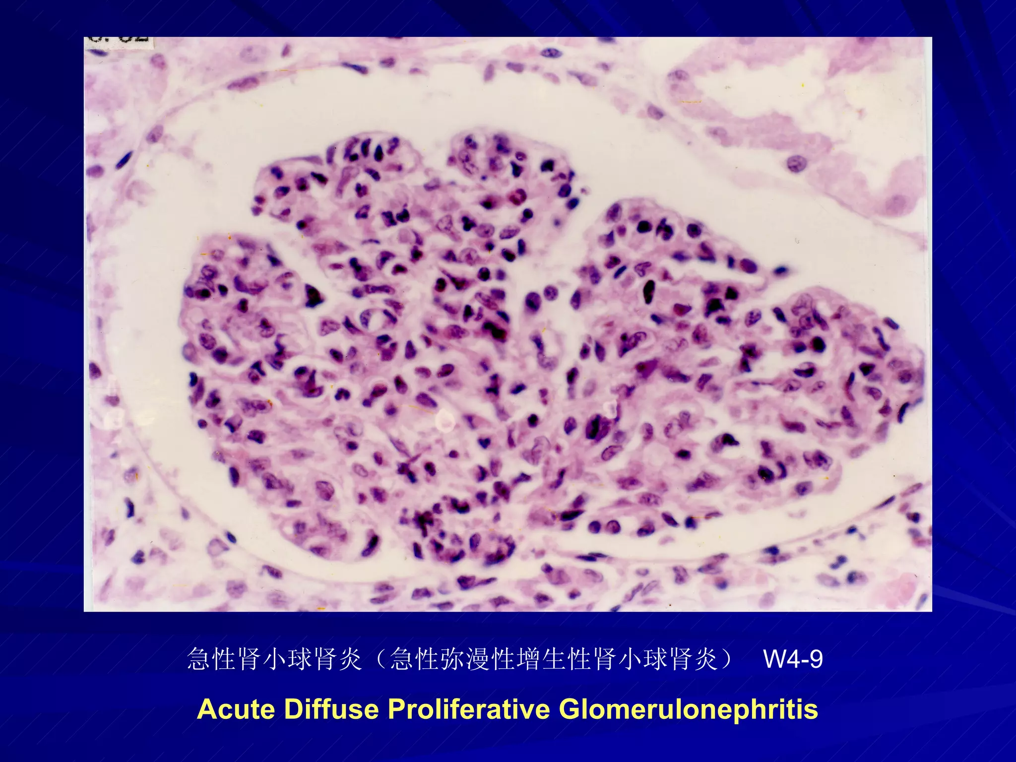 pathology practical original slide NO4
