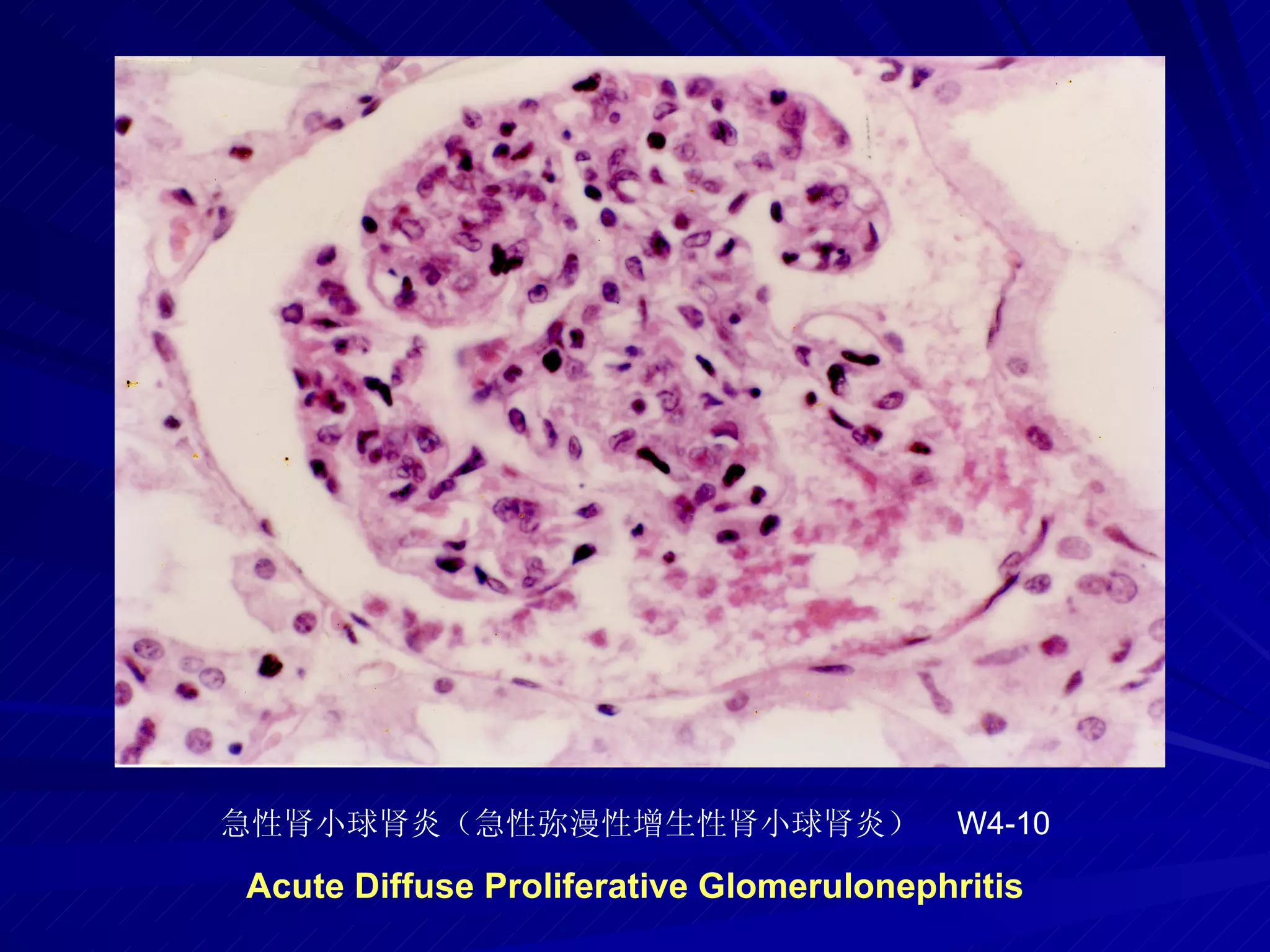 pathology practical original slide NO4