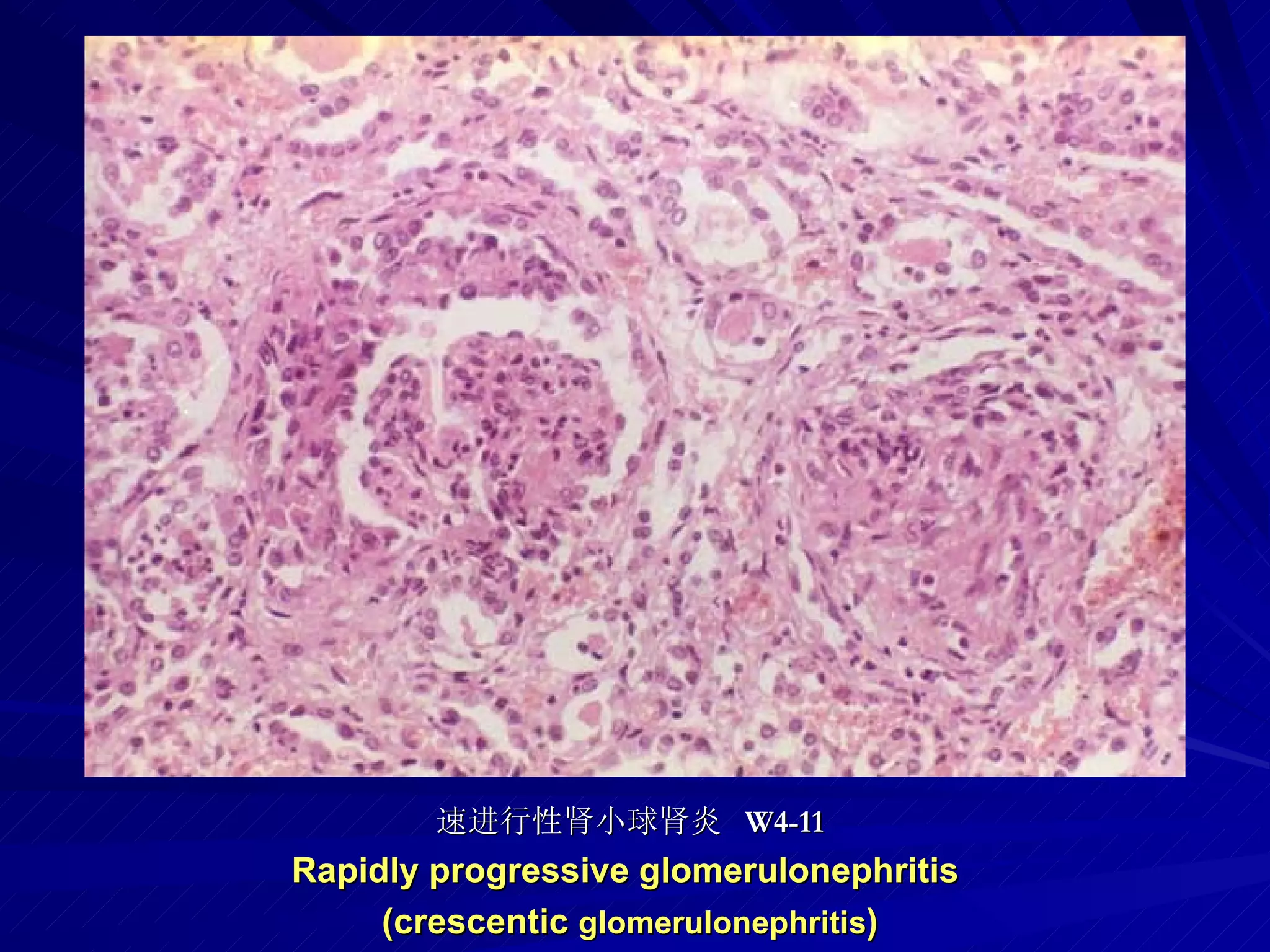 pathology practical original slide NO4