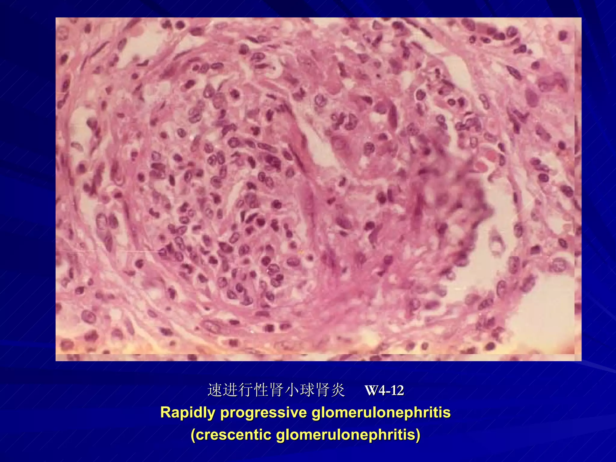 pathology practical original slide NO4