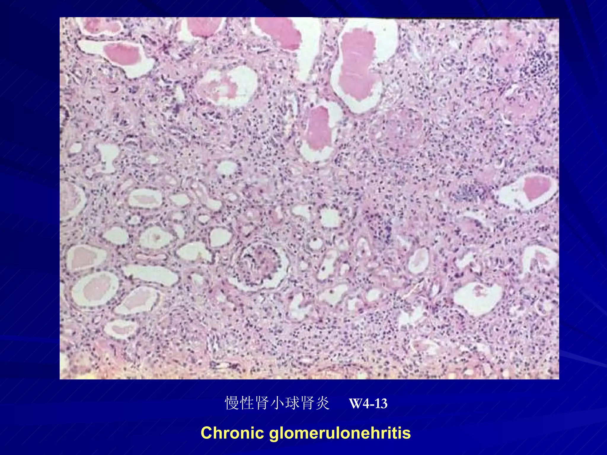pathology practical original slide NO4
