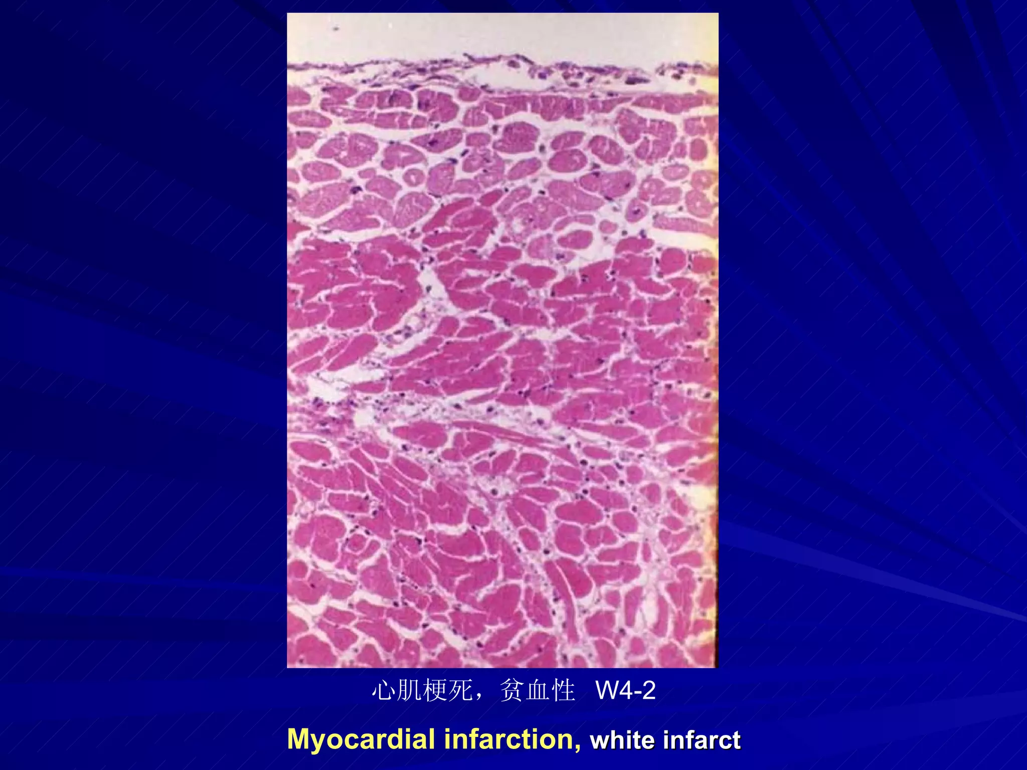pathology practical original slide NO4