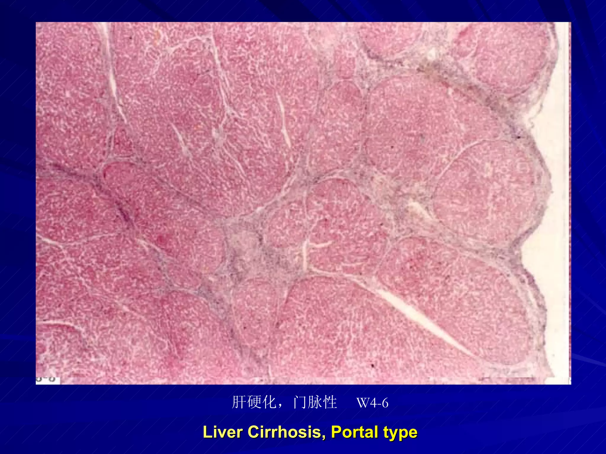 pathology practical original slide NO4