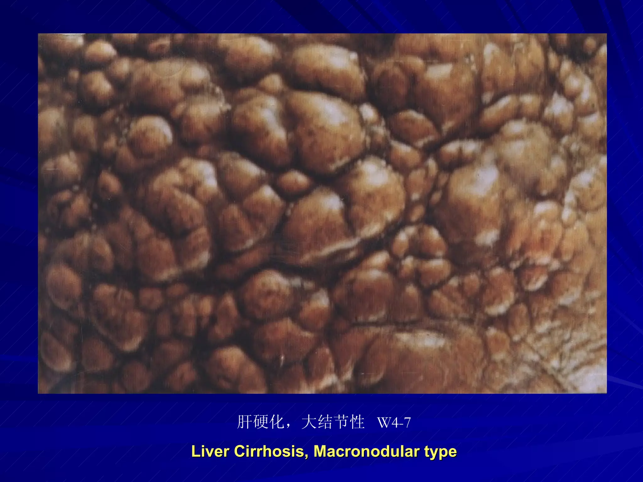 pathology practical original slide NO4