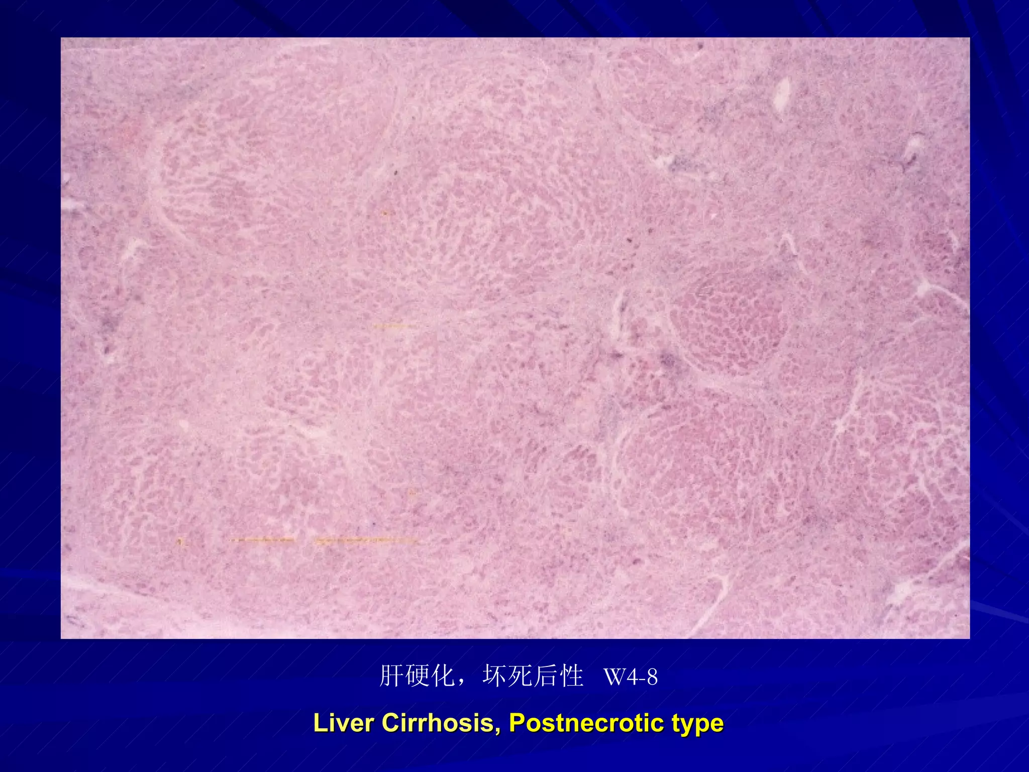 pathology practical original slide NO4