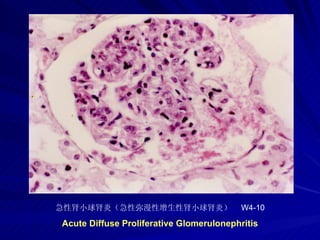 pathology practical original slide NO4