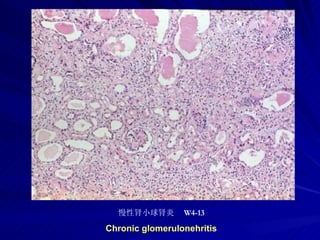 pathology practical original slide NO4
